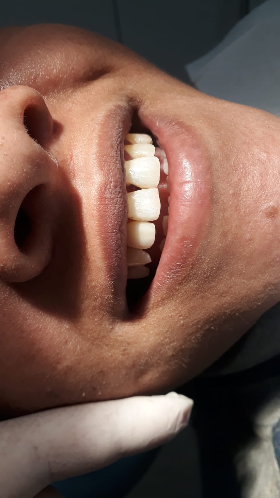 ODONTOLOGIA HUMANIZADA NO CAMPO ALEGRE