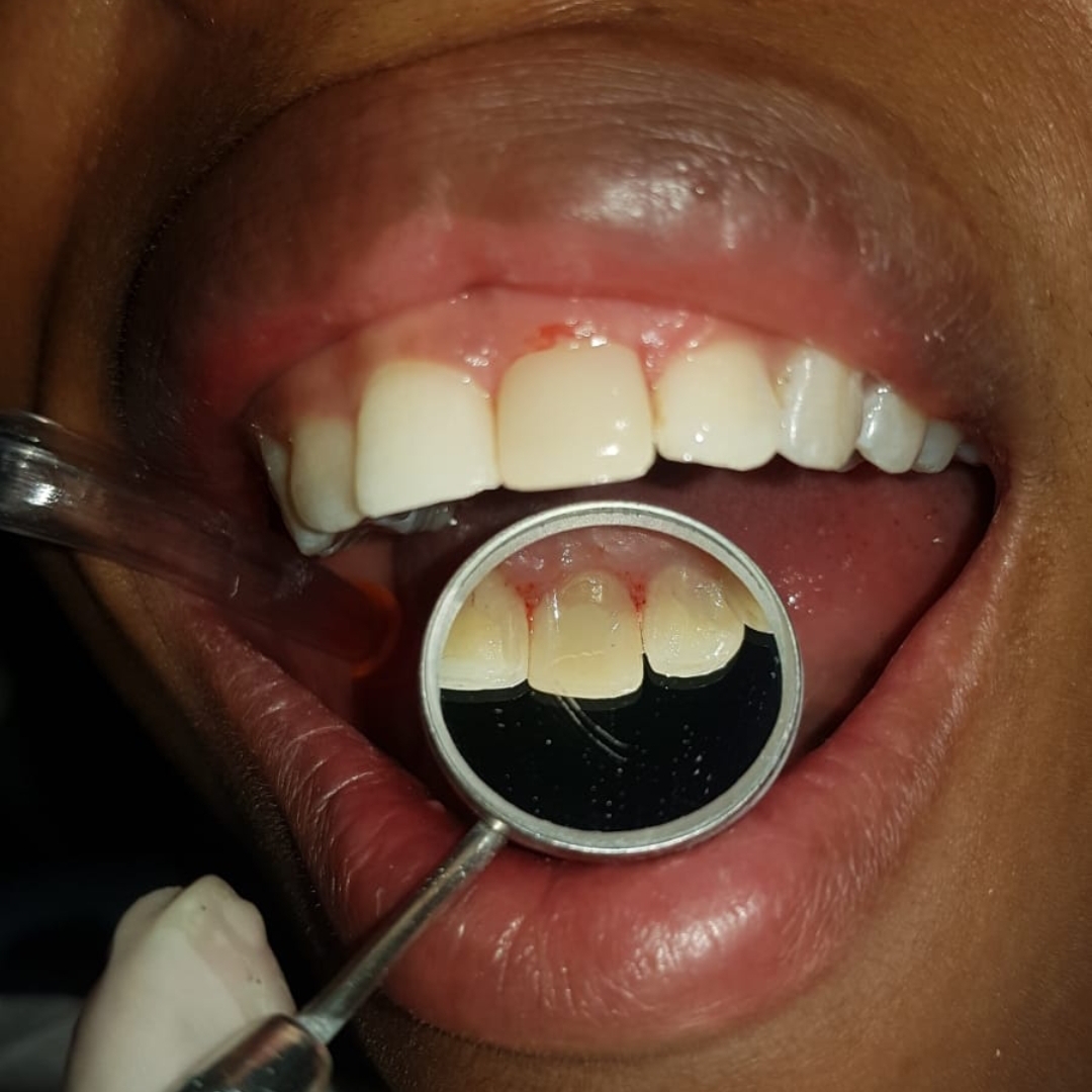 ATENDIMENTO HUMANIZADO NA ODONTOLOGIA EM INDIANÓPOLIS